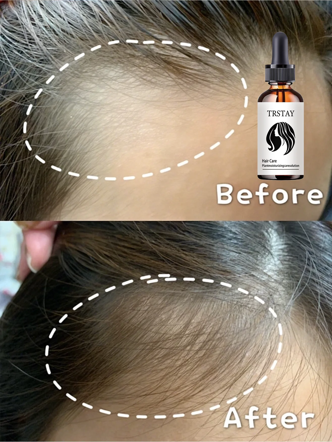 Moisturizing Advanced Hair Smoothing Treatment For Strong Glossy Hair Gradually Improves Hair Health With Multiple Specs To Nour