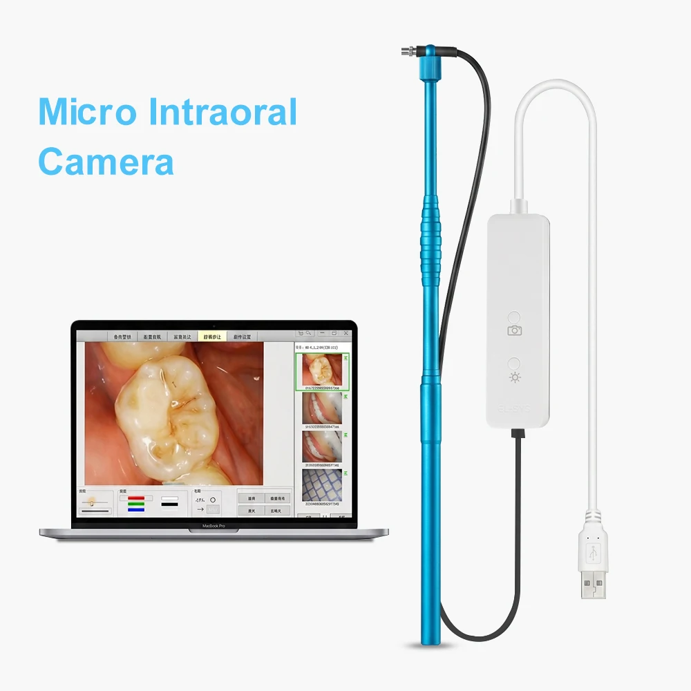 5MP Micro Intraoral Camera Dental Intra Oral camera HD USB mini Visual Tooth Camera for Teeth Root Canal Treatment on Windows PC