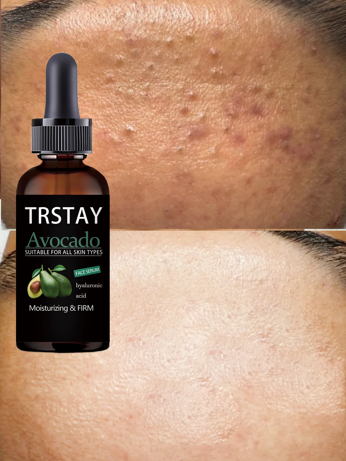 Aceite Facial hidratante 24H, tratamiento nutritivo con bloqueo de humedad profunda para una piel seca y apretada, alivio instantáneo con aceites naturales, Glo radiante