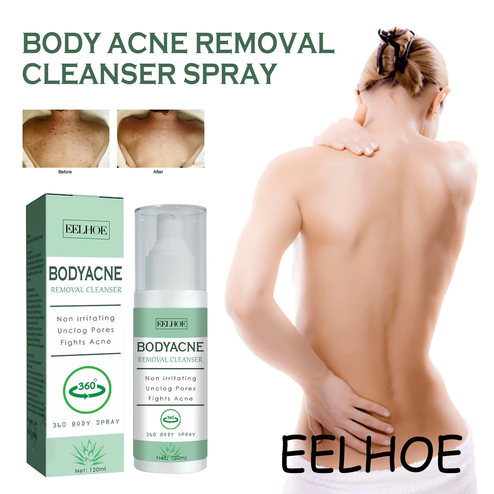 

EELHOE Body Acne Care Spray Remove Acne Scars Moisturizing Oil Control Gentle Remove Dead Skin Acne Removal Cleaner Spray