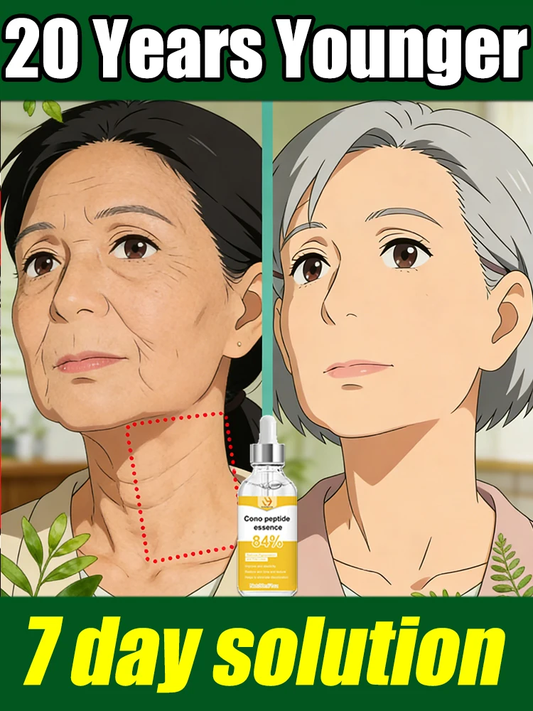 Deep wrinkles less wrinkled