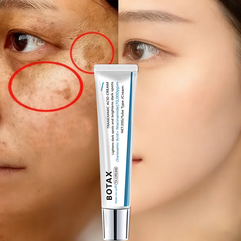 Water Ice Levin Tranexamic Aci - Skincare Niacinamide recension och pris