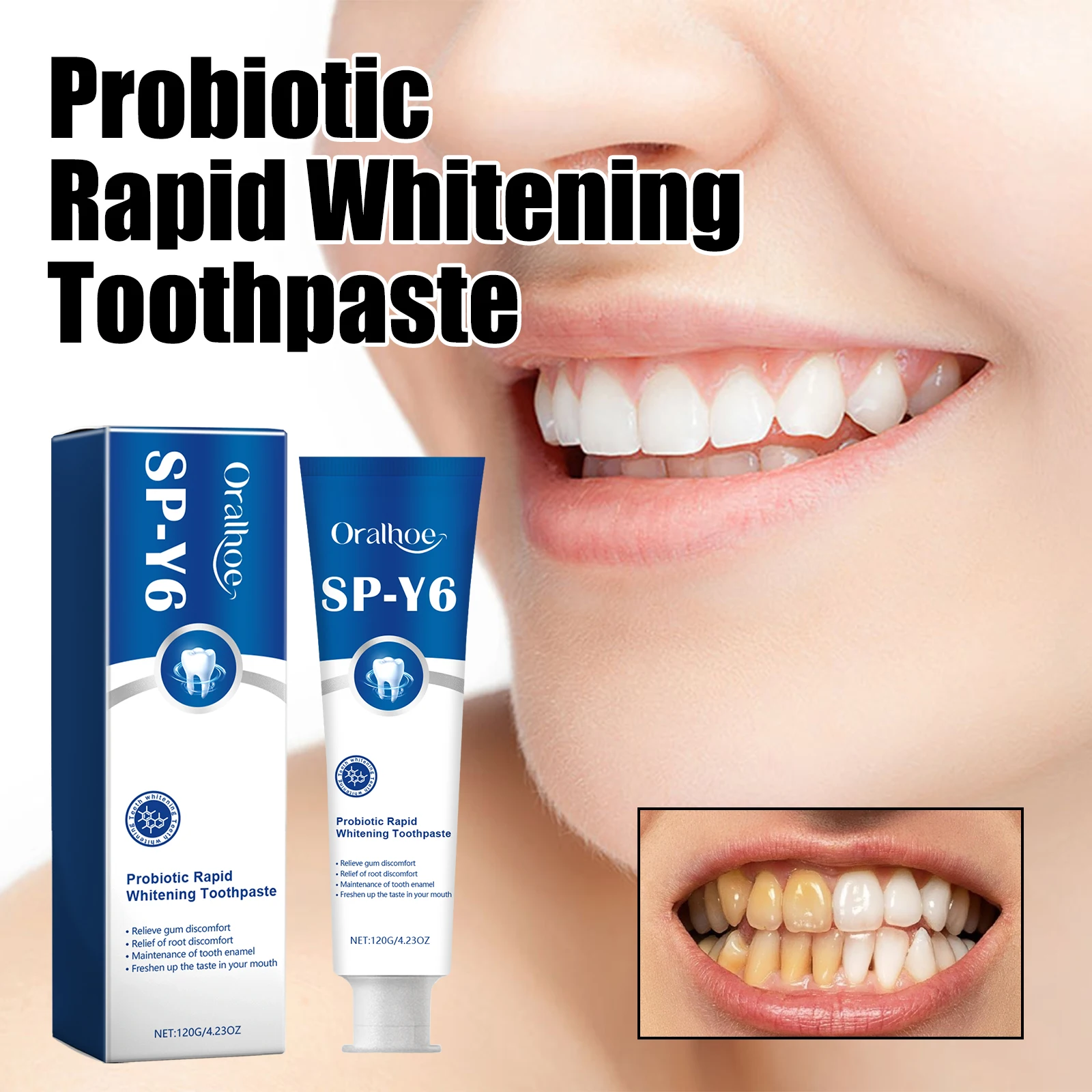 SP-Y6 Maintenance Tooth Enamel Whiten Toothpaste Improving Oral Mint Fresh Breath Remove Stains Probiotic Whitening Toothpaste