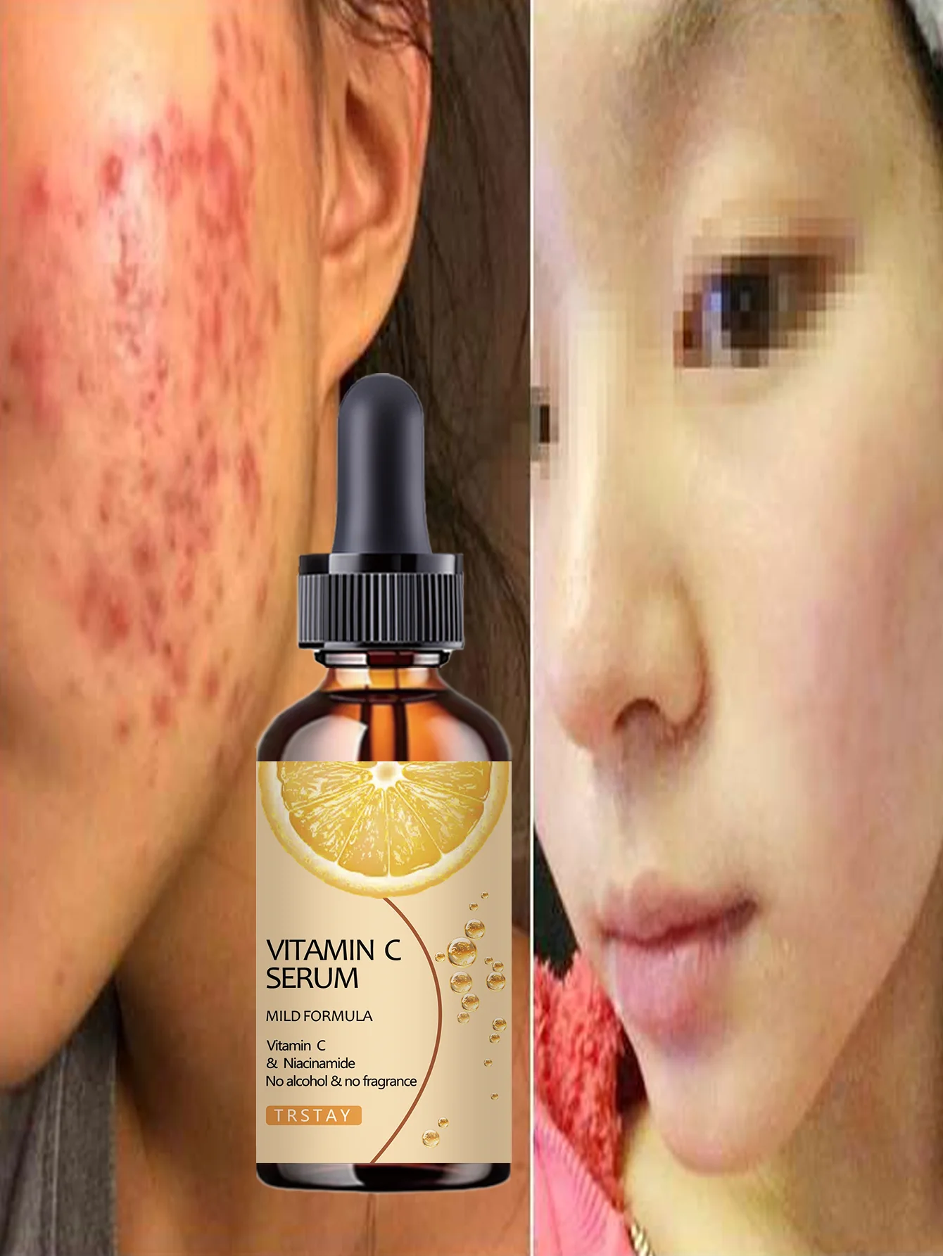 Hydrating Lightweight Serum Deeply Moisturizes Enhances Skin Firmness Creates Plump Youthful Skin Smooth Soothing Treatment for - Image 2