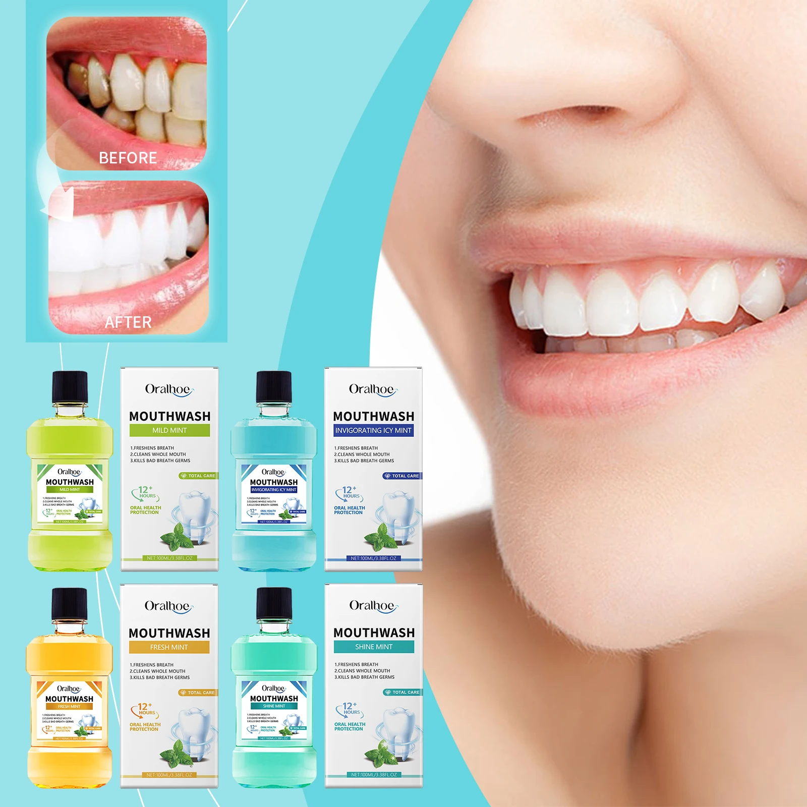 Oralhoe Enjuague bucal ambientador para aliento fresco, cuidado diario de los dientes, limpieza de manchas de dientes, enjuague bucal de olores
