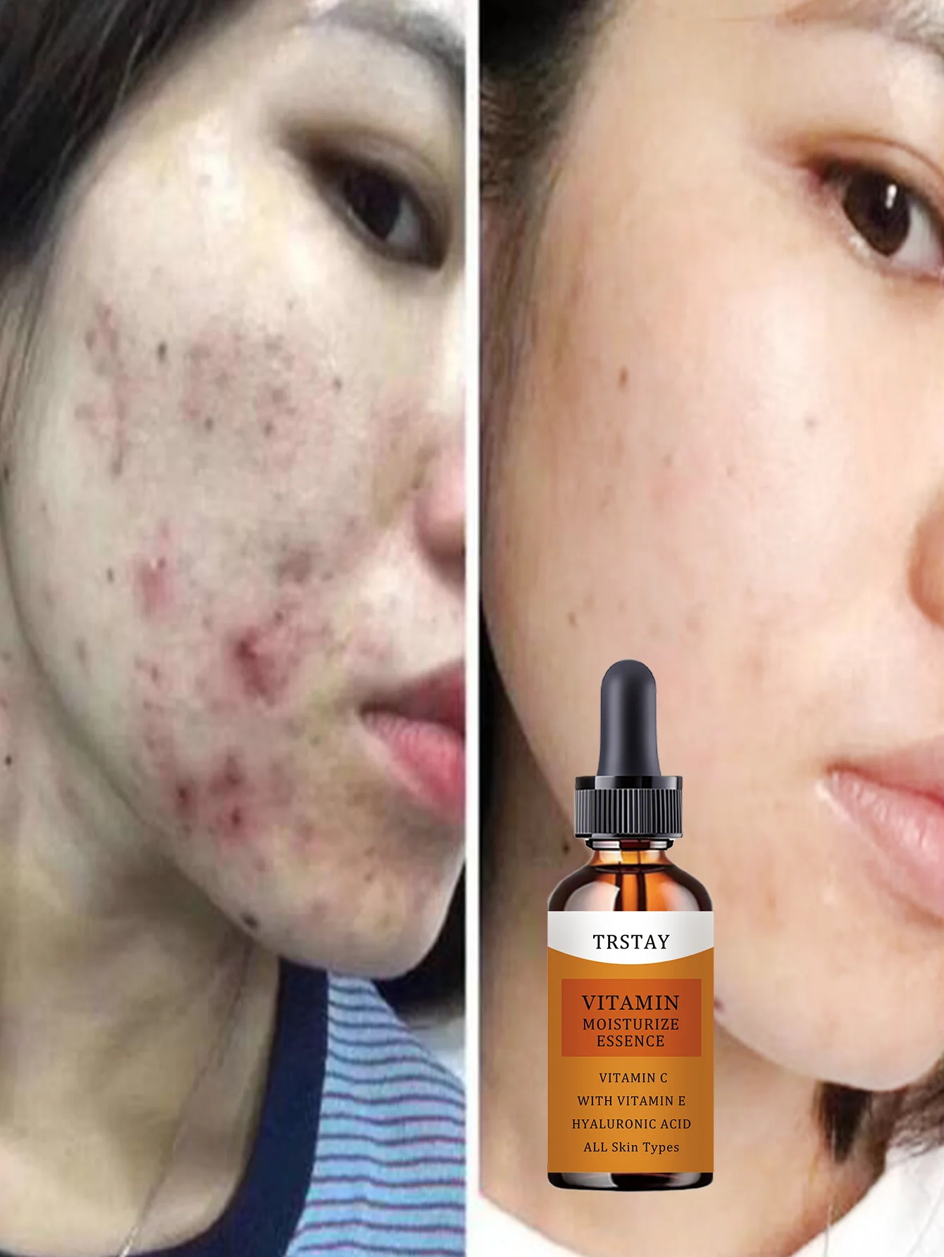 Hydrating Lightweight Nourishing Oil for Dehydrated Skin Deep Moisture Repair Serum with Natural Ingredients for Dry Sensitive S - Image 5