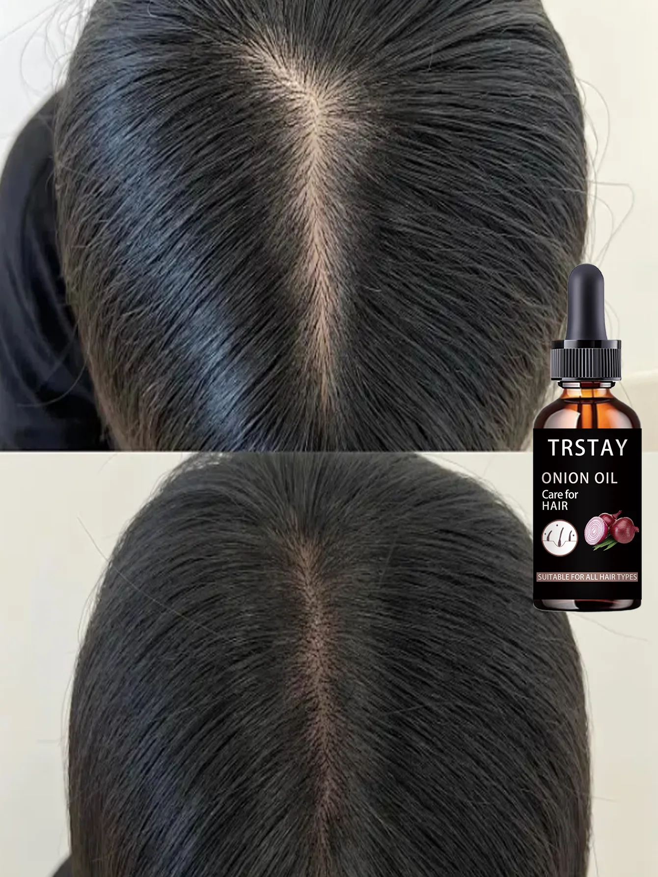 Moisturizing Intensive Curly Hair Treatment Deeply Hydrates Repairs Damaged Hair Boosts Elasticity Creates Soft Thick Dandruff F - Image 5