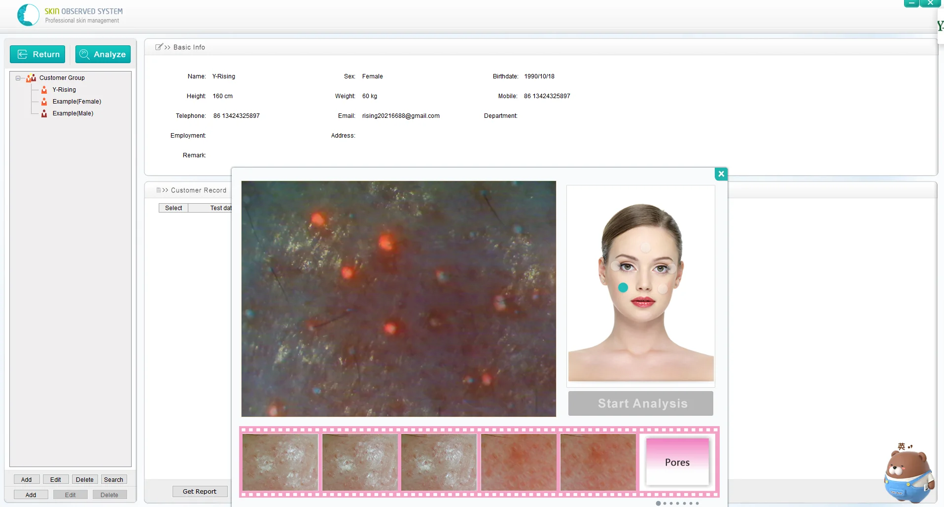 Sistema de cuidado facial de alta definición de 5 millones de píxeles Operación inteligente Diagnóstico automático Epidermia facial Derme analizador de piel