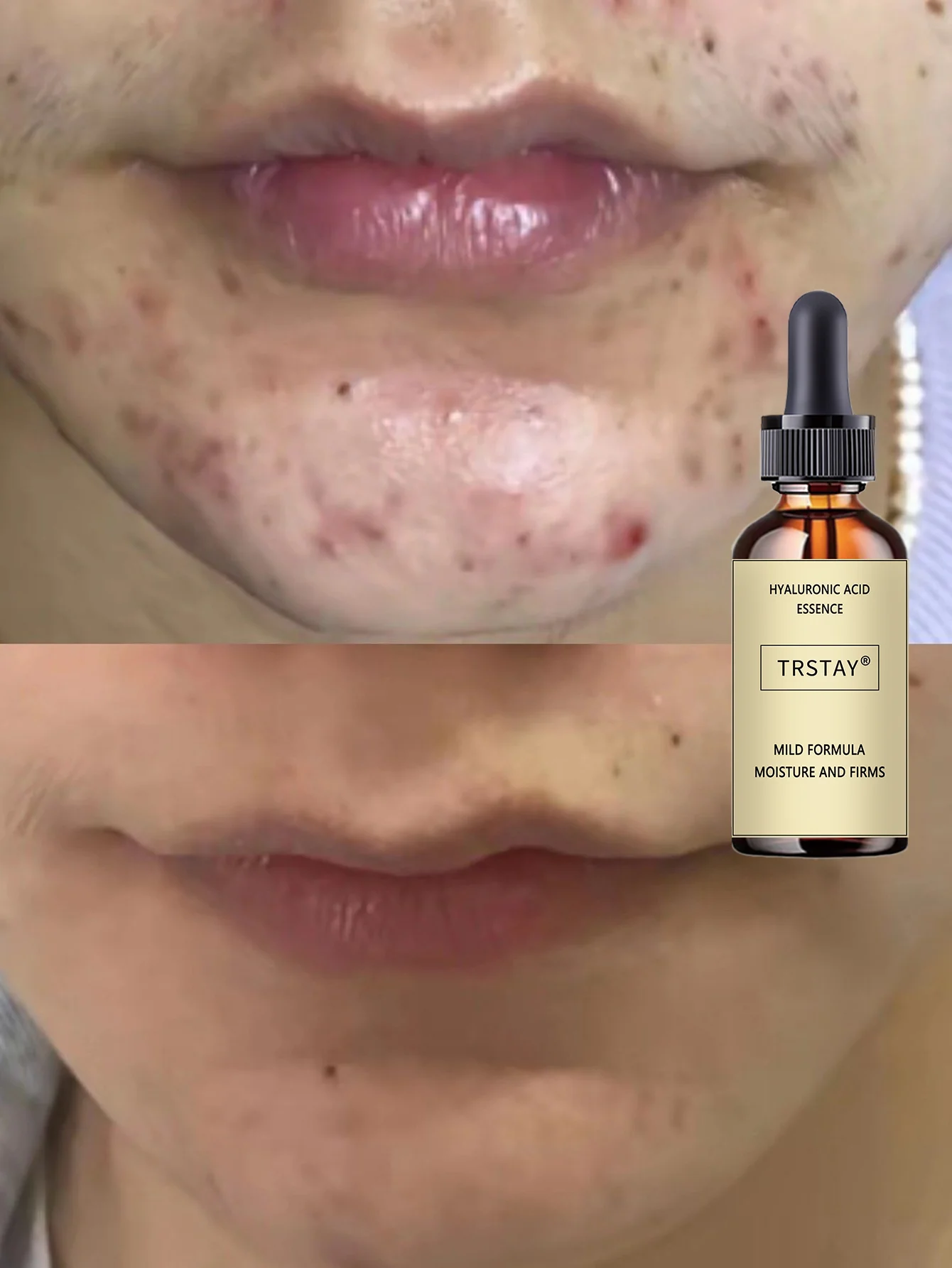 Hydrating Water Light Facial Oil for All Skin Types Deep Moisturizing Nourishing Serum with Natural Extracts Lightweight Non Gre - Image 6