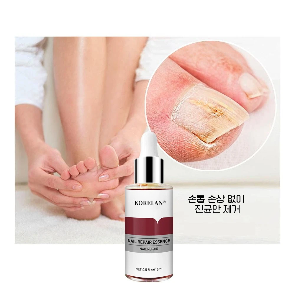 Problem claw athlete's foot fungus treatment