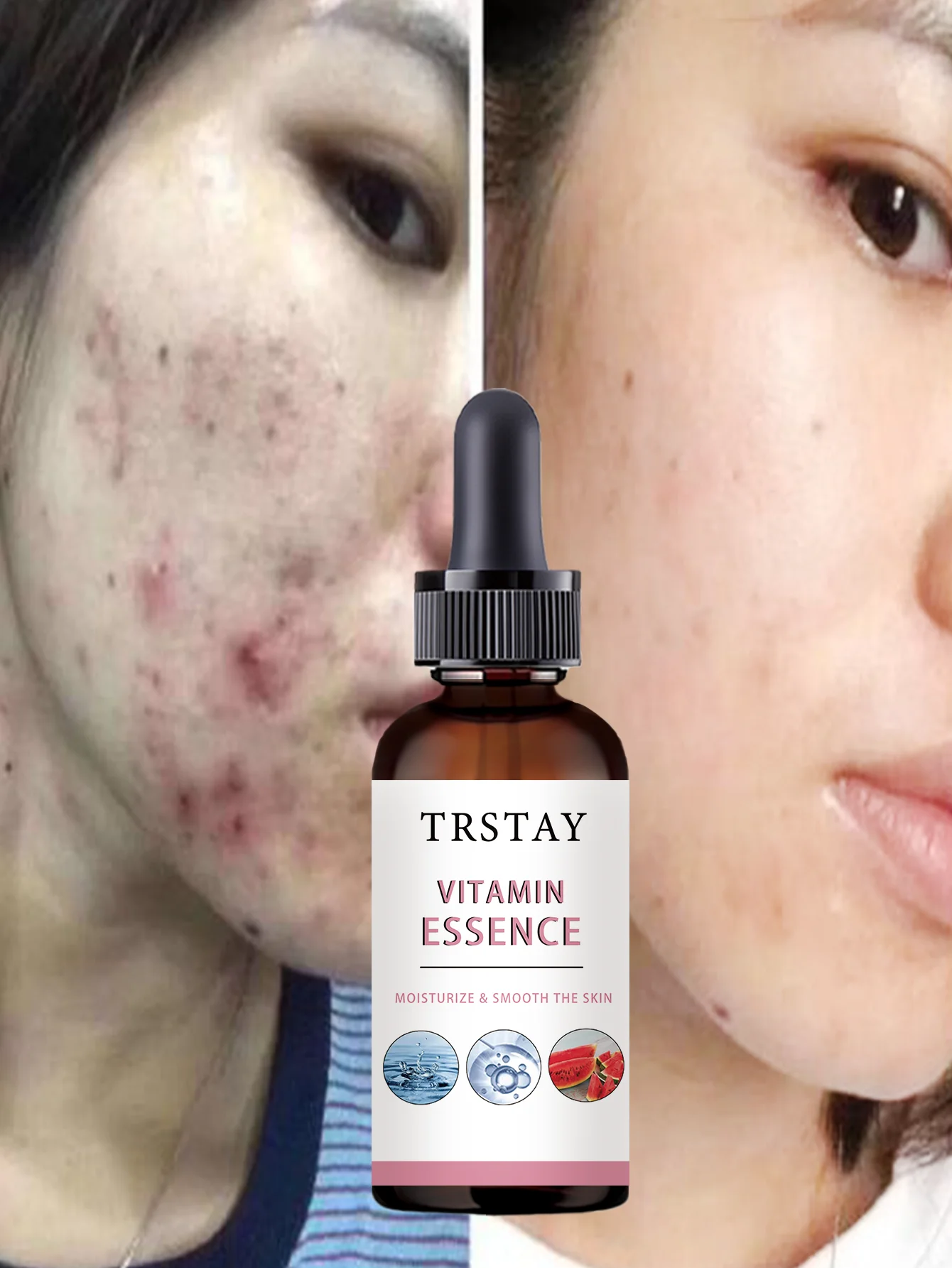 Hydrating Facial Oil Deep Nourishment Serum Relieves Dry Tightness for Smooth Glowing Skin Moisturizing Treatment with Natural I - Image 6