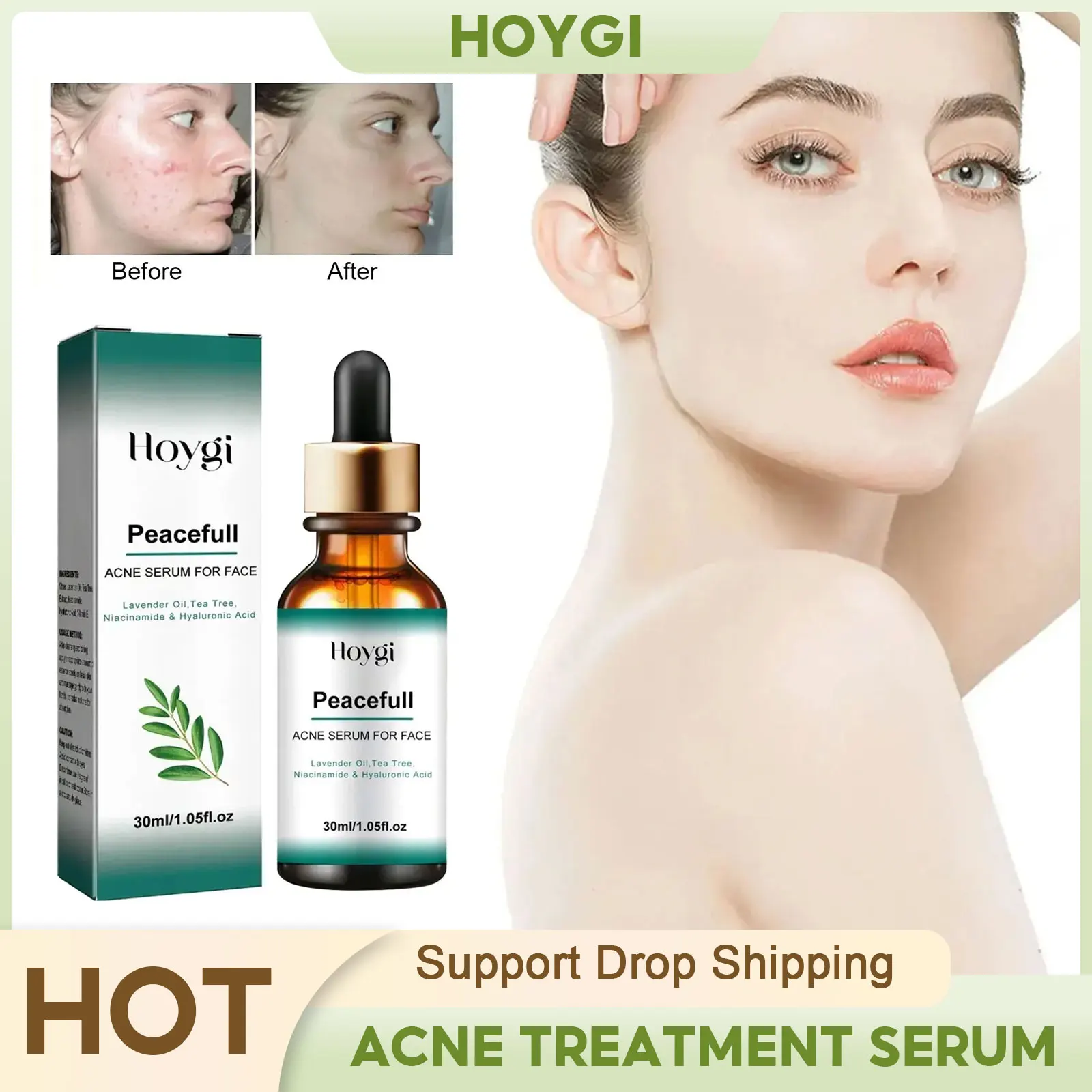 Acne Treatment Serum Lightening Dark Spots Shrinking Pores Repairing Oil Control Moisturizing Whitening Pimples Remover Essence