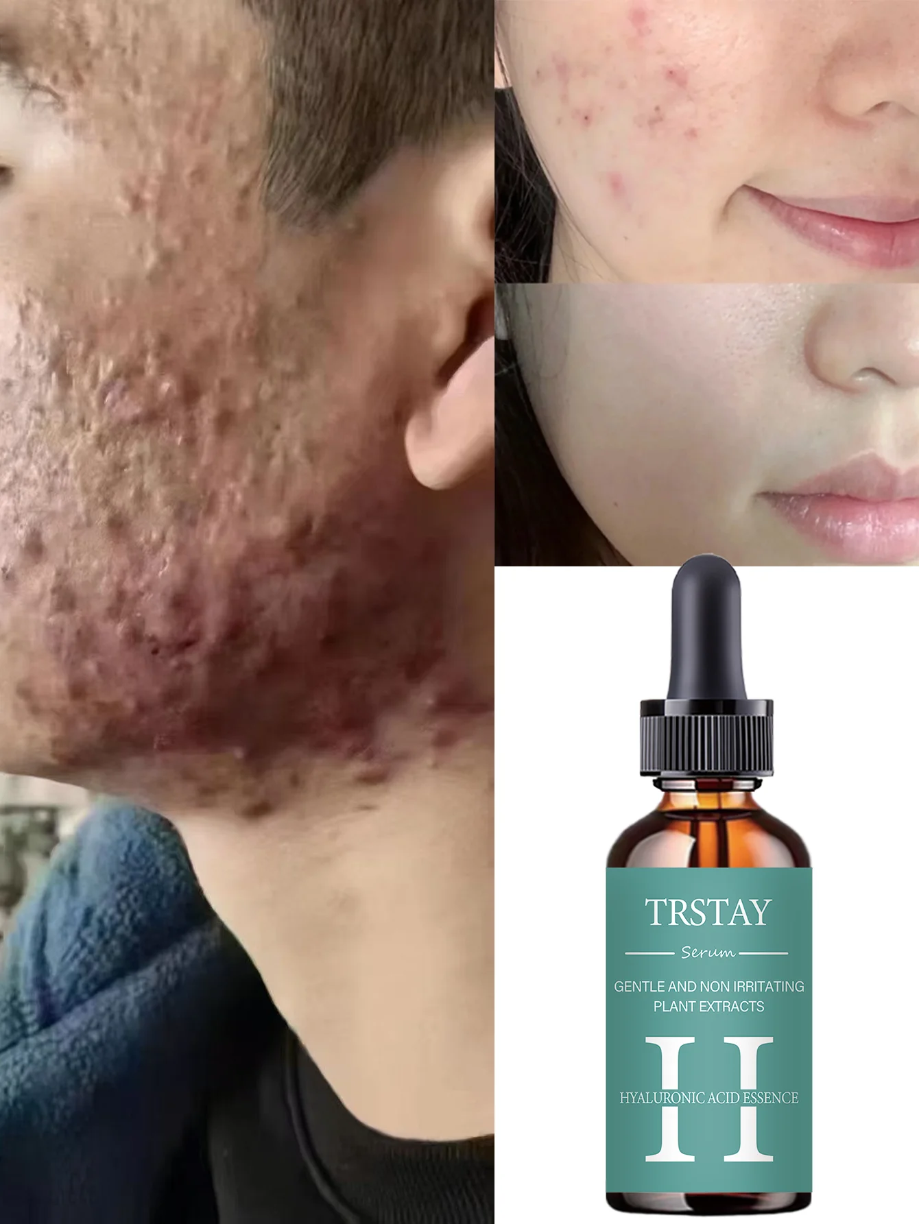 Hydrating Facial Oil Travel-Size On-the-Go Moisture Boost for Dry Skin Nourishing and Revitalizing Serum with Natural Ingredient - Image 5