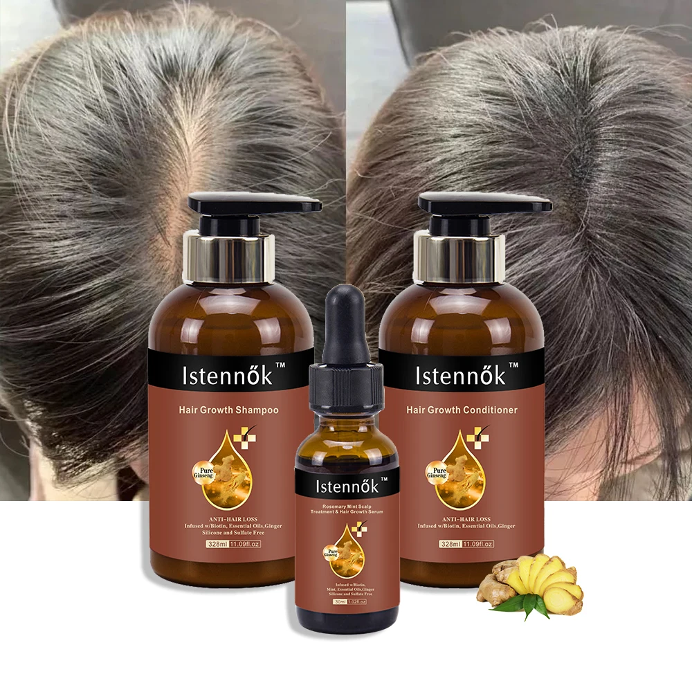 2023 Professional Hair Growth Products Shampoo And Conditioner Serum For Women Men Ginger Hair Regrowth Set Anti Hair Loss