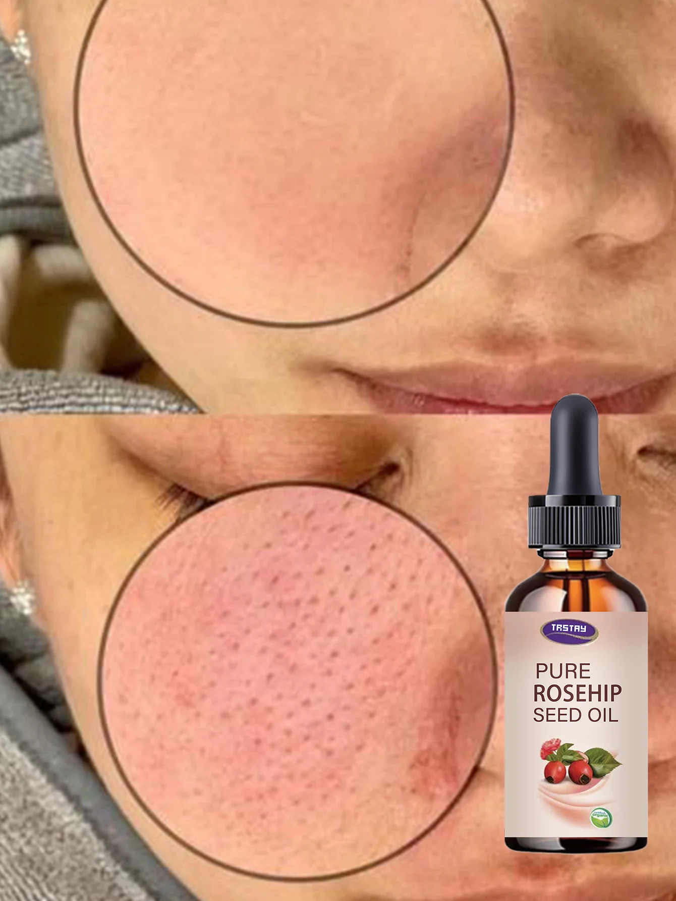 Advanced Hydrating Serum with Vitamin E for Deep Moisture Lock and Skin Barrier Repair Promotes Youthful Glow Suitable for All S - Image 6