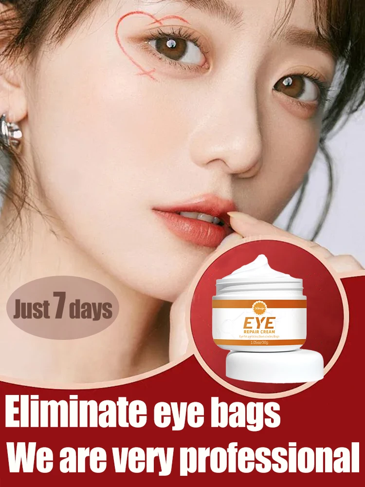 eye bag removal cream