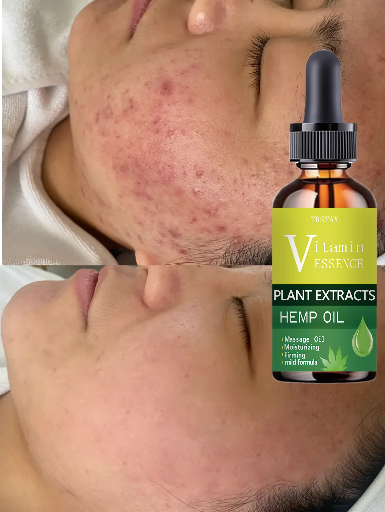 Hydrating Spot Removing Anti Wrinkle Brightening Firming Lifting Facial Serum for Radiant Youthful Skin with Deep Hydration and - Image 3