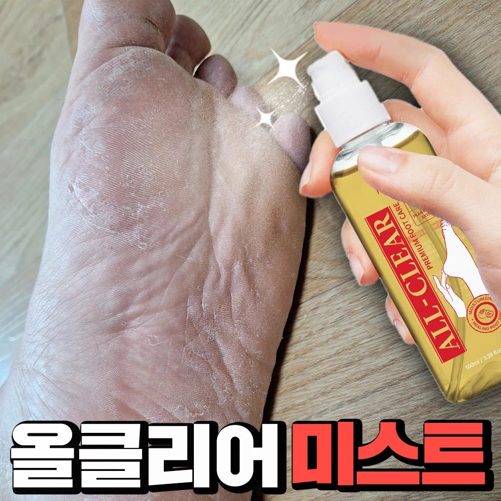 [특가 한정판매] 메디올가 올 클리어 발냄새 발각질 케어 각종 발 고민해결 풋 미스트