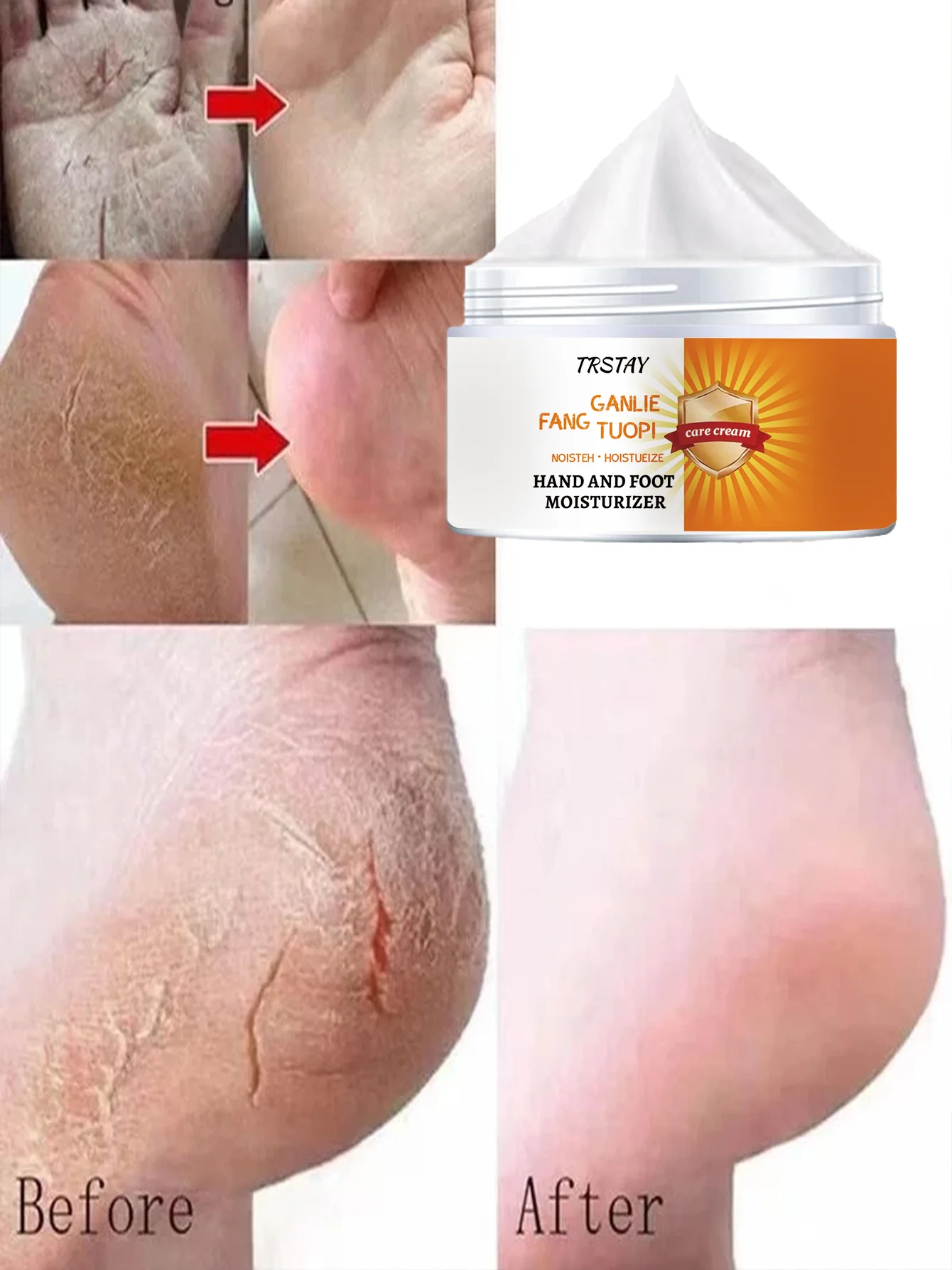 

Глубоко увлажняющий крем для ног восстанавливает сухие потрескавшиеся пятки обеспечивает длительное увлажнение, смягчает грубую кожу на подошве для гладкости.