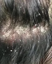 Semana 1