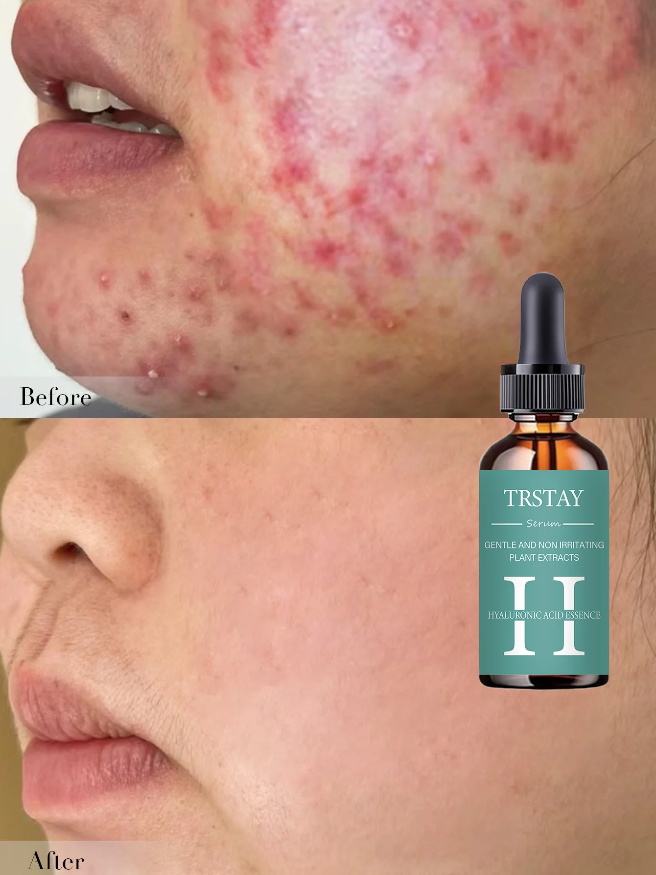 Hydrating Facial Oil Travel-Size On-the-Go Moisture Boost for Dry Skin Nourishing and Revitalizing Serum with Natural Ingredient - Image 6