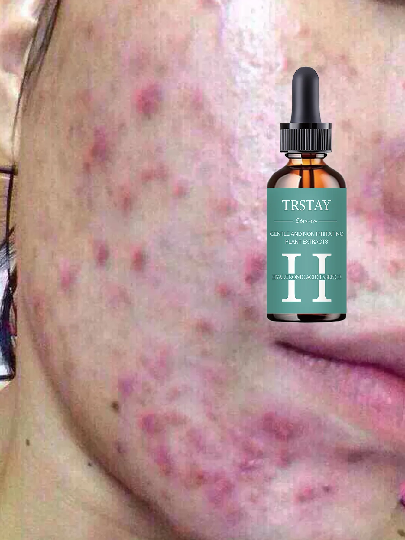 Hydrating Facial Oil Travel-Size On-the-Go Moisture Boost for Dry Skin Nourishing and Revitalizing Serum with Natural Ingredient - Image 3