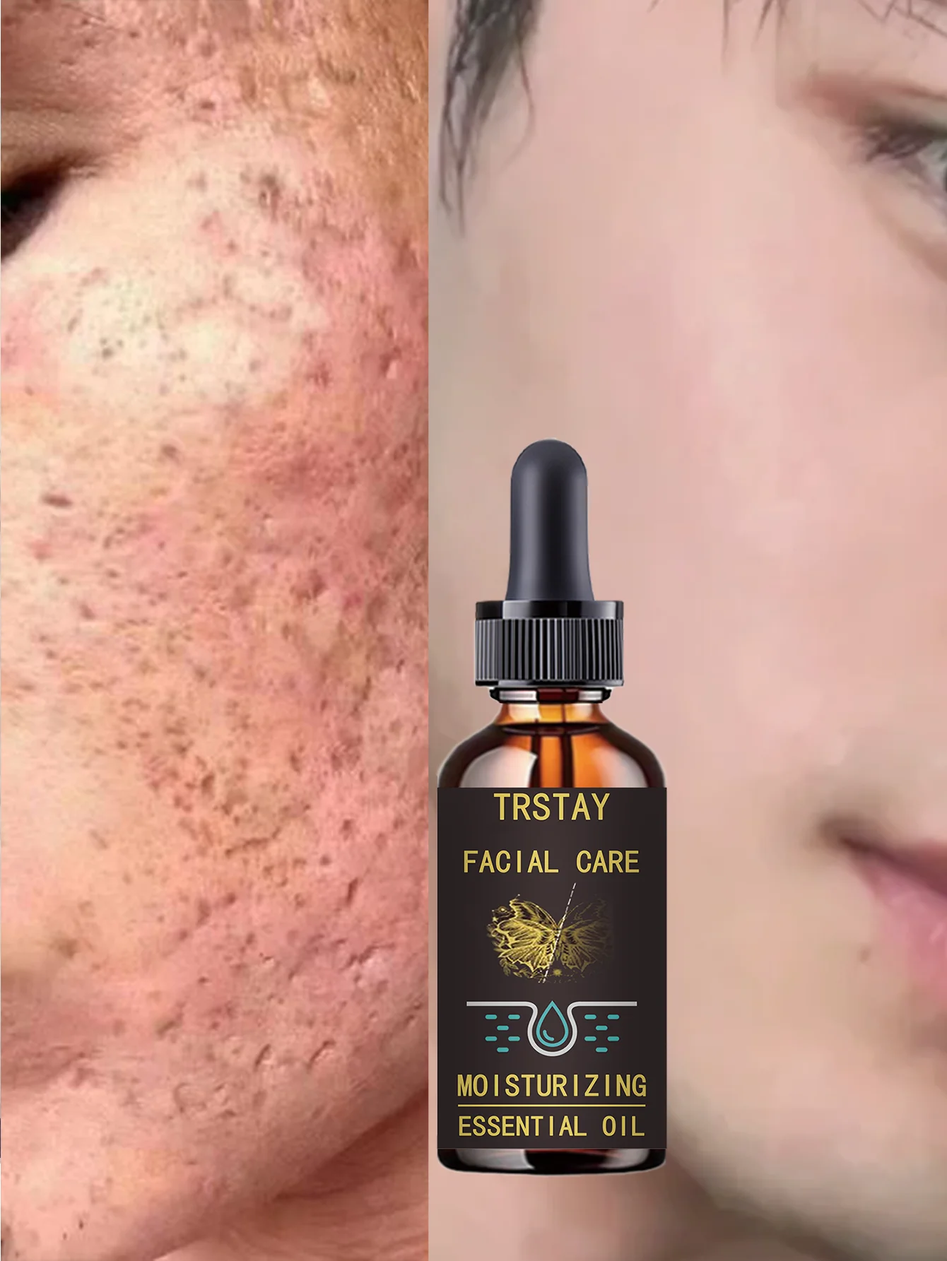 Deeply Moist Anti Wrinkle Essence Milk for Tender Skin with Whitening Benefits Hydration Treatment to Improve Skin Texture and P