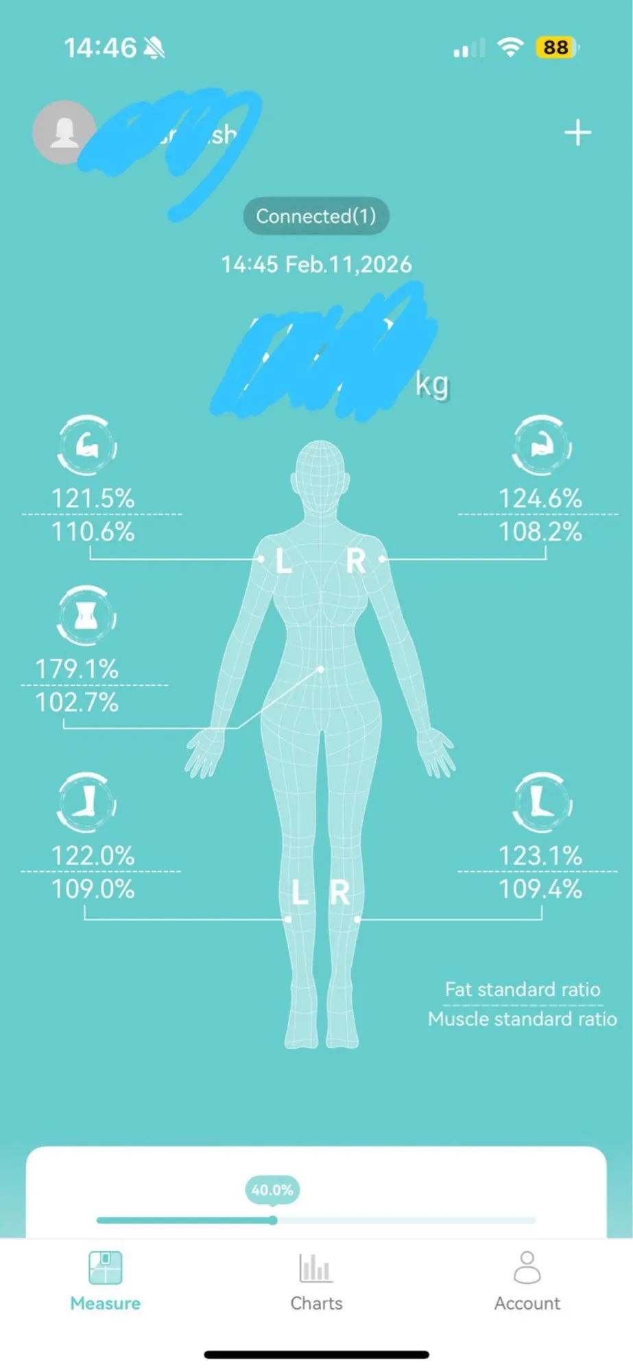Smart Body Composition Scale with Handheld Sensor – 1.5 m Spiral Cable | Fitness & Health Tracker