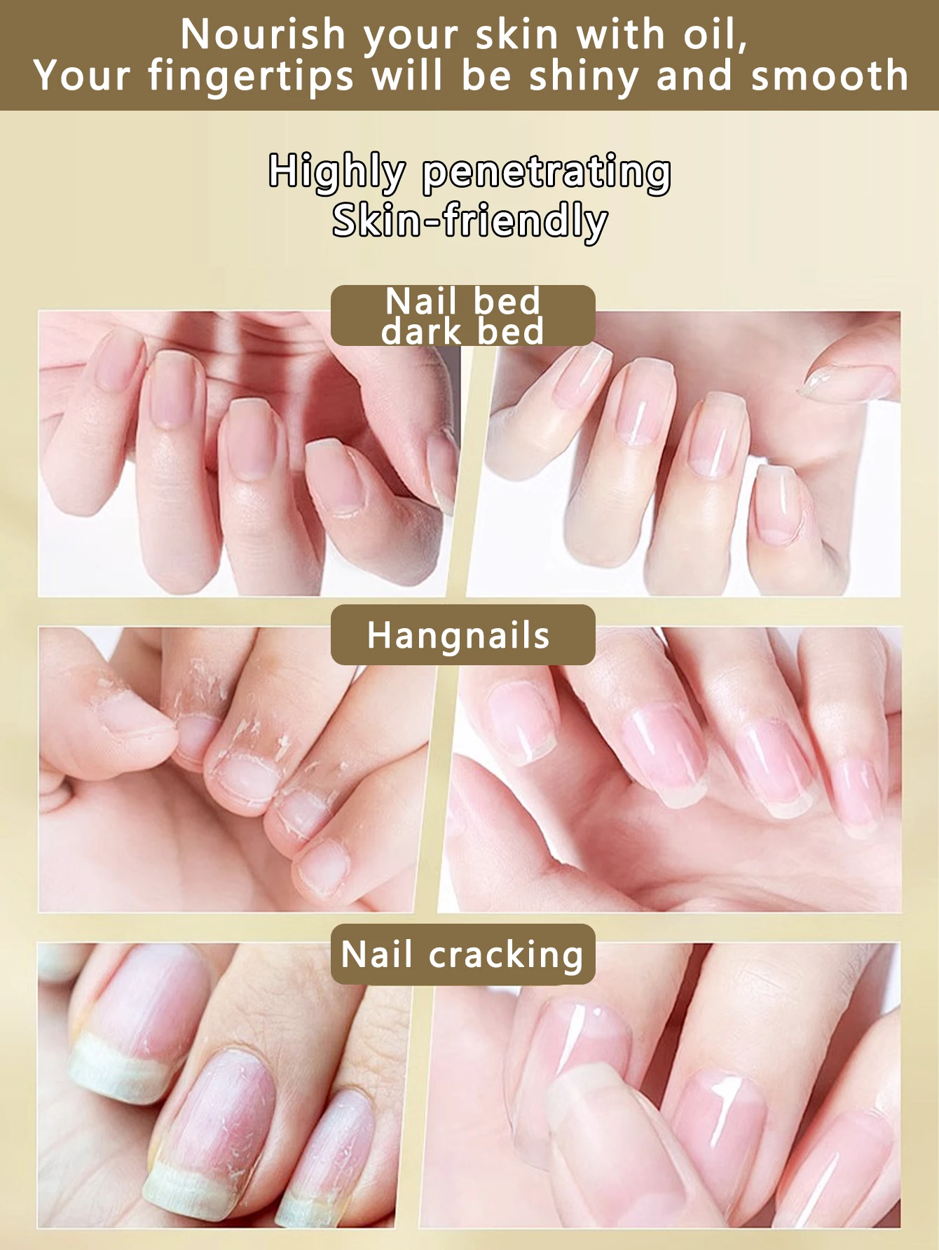 73ML โภชนาการเล็บน้ํามันหนังกําพร้าบํารุงซ่อมแซมชุ่มชื่นกระจ่างใสป้องกันหนามผิวที่ตายแล้วน้ํามันขอบดูแลเล็บ