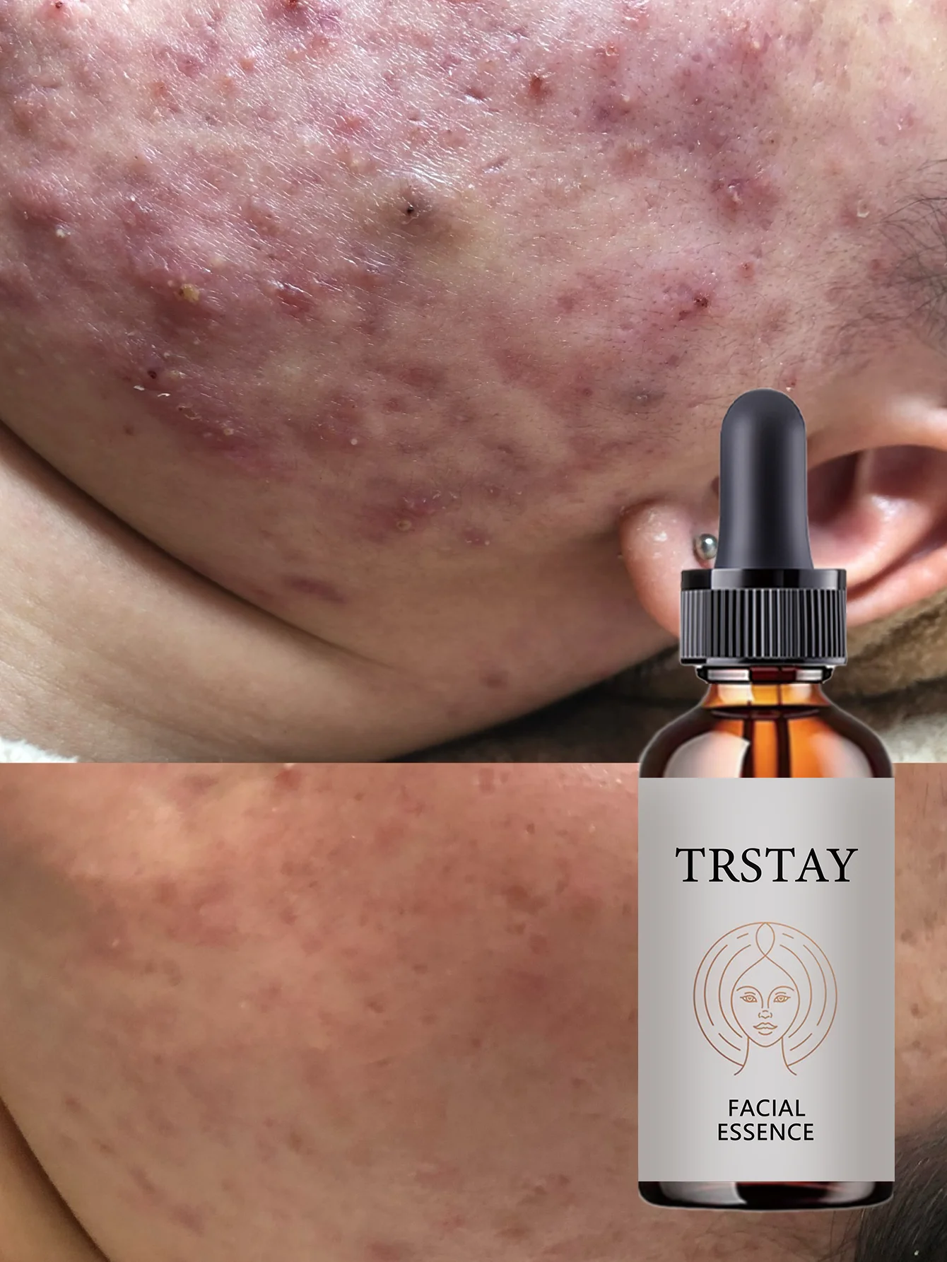 Hydrating Facial Oil Quick Absorption No Shine Lightweight Non Greasy Formula for All Skin Types Deep Moisturizing Serum with Na - Image 6