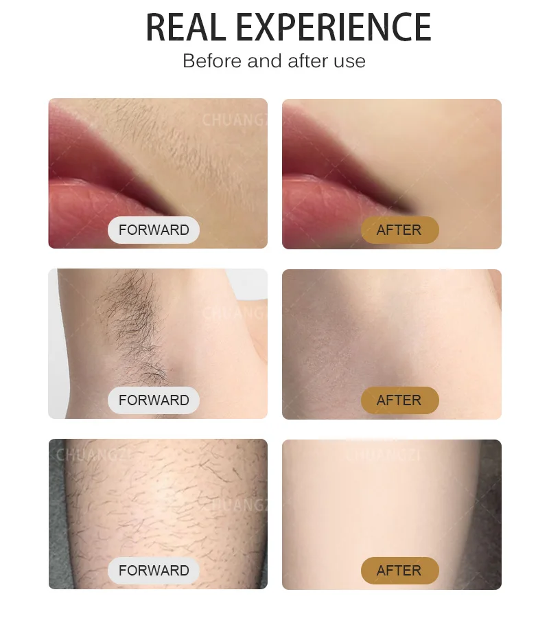 Professional Diode Ice Titanium Laser Body Hair Removal Machine Portable 808 755 1064 Device 3 waves IPL Permanent CE Woman