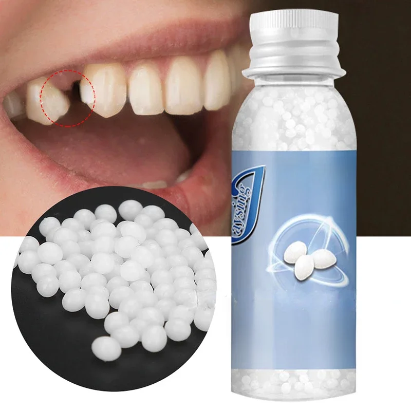Perles de réparation dentaire temporaire, dents cassées manquantes, matériau de remplissage dentaire, fausses dents de qualité alimentaire, colle solide, prothèse dentaire