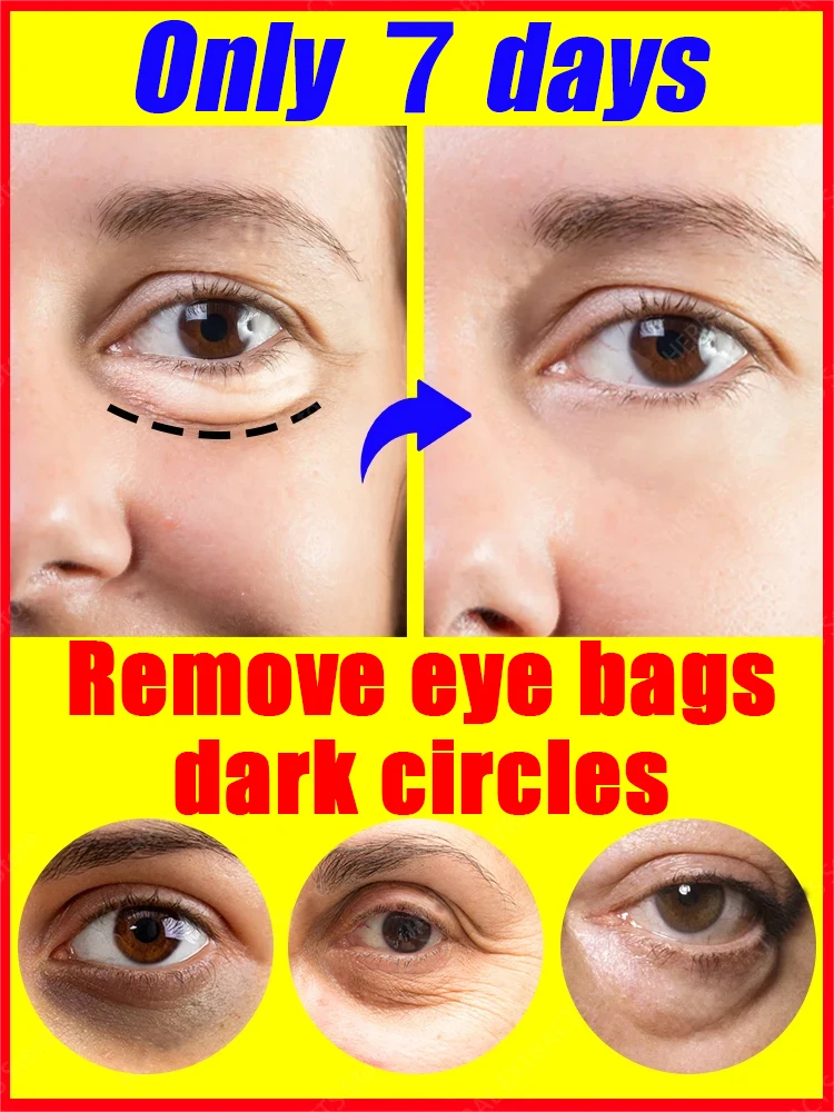 Solve all eye problems