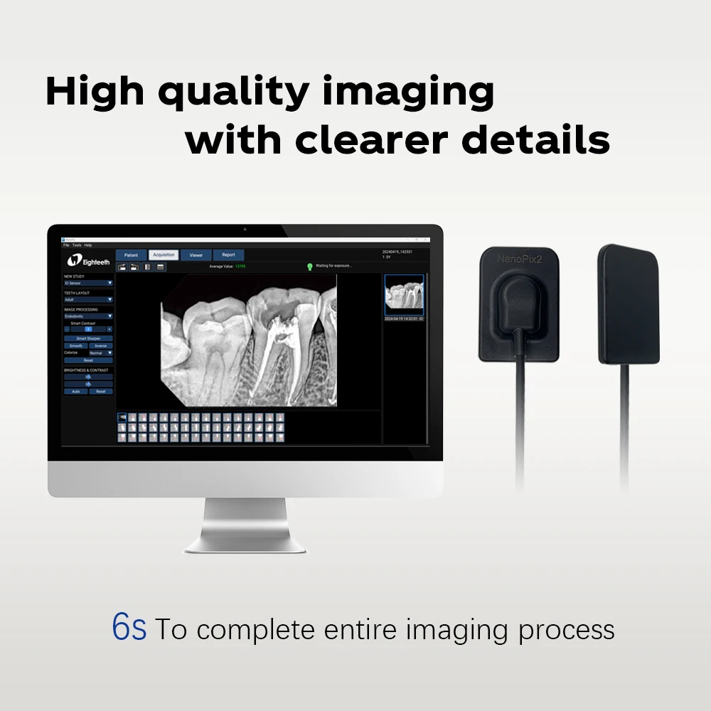 Eighteeth NanoPix Sensor Digital Dental, sistema de máquina de imagen portátil, sistemas de sensores veterinarios para unidades, herramientas de