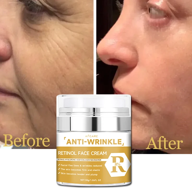 Retinol Wrinkle Removal Cream Fade Face Line Instant Anti Aging Moisturizing Lifting Aging Facial Cream Skin Care Beauty