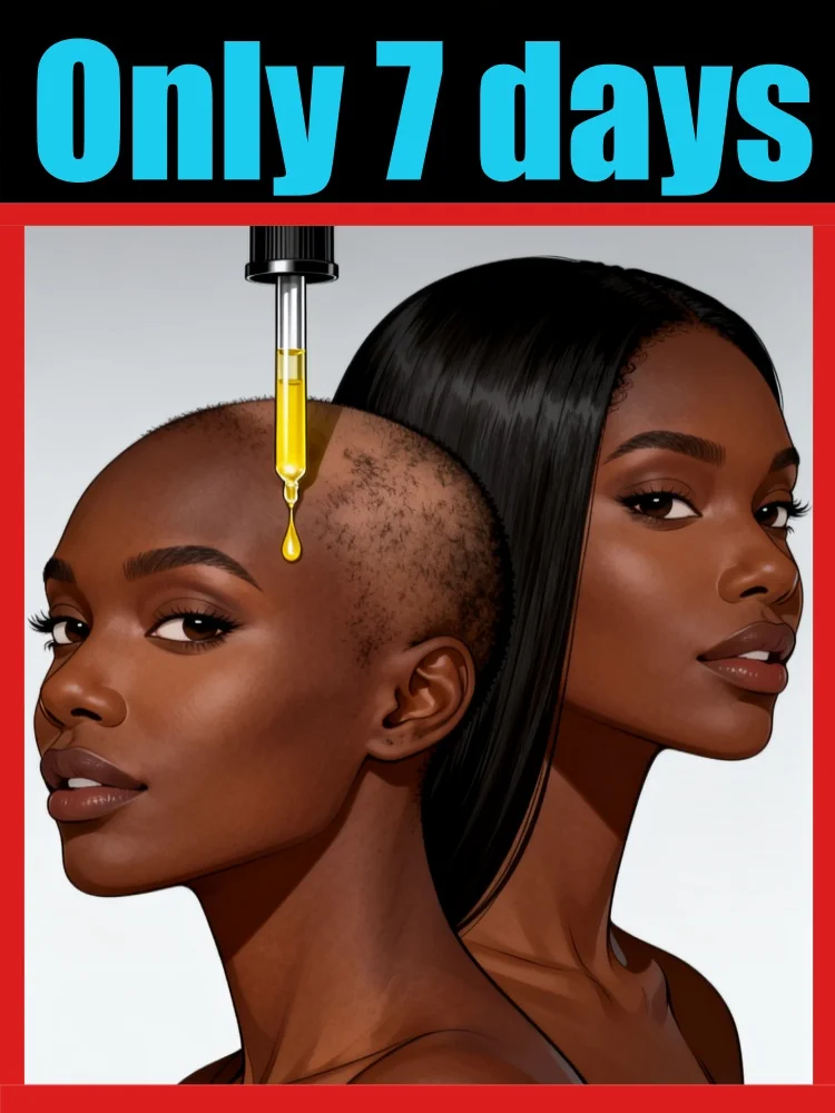 Calvície em áreas diferentes, tratamento em áreas diferentes, restauração de linha fina, ferramentas para cuidados com folículos capilares