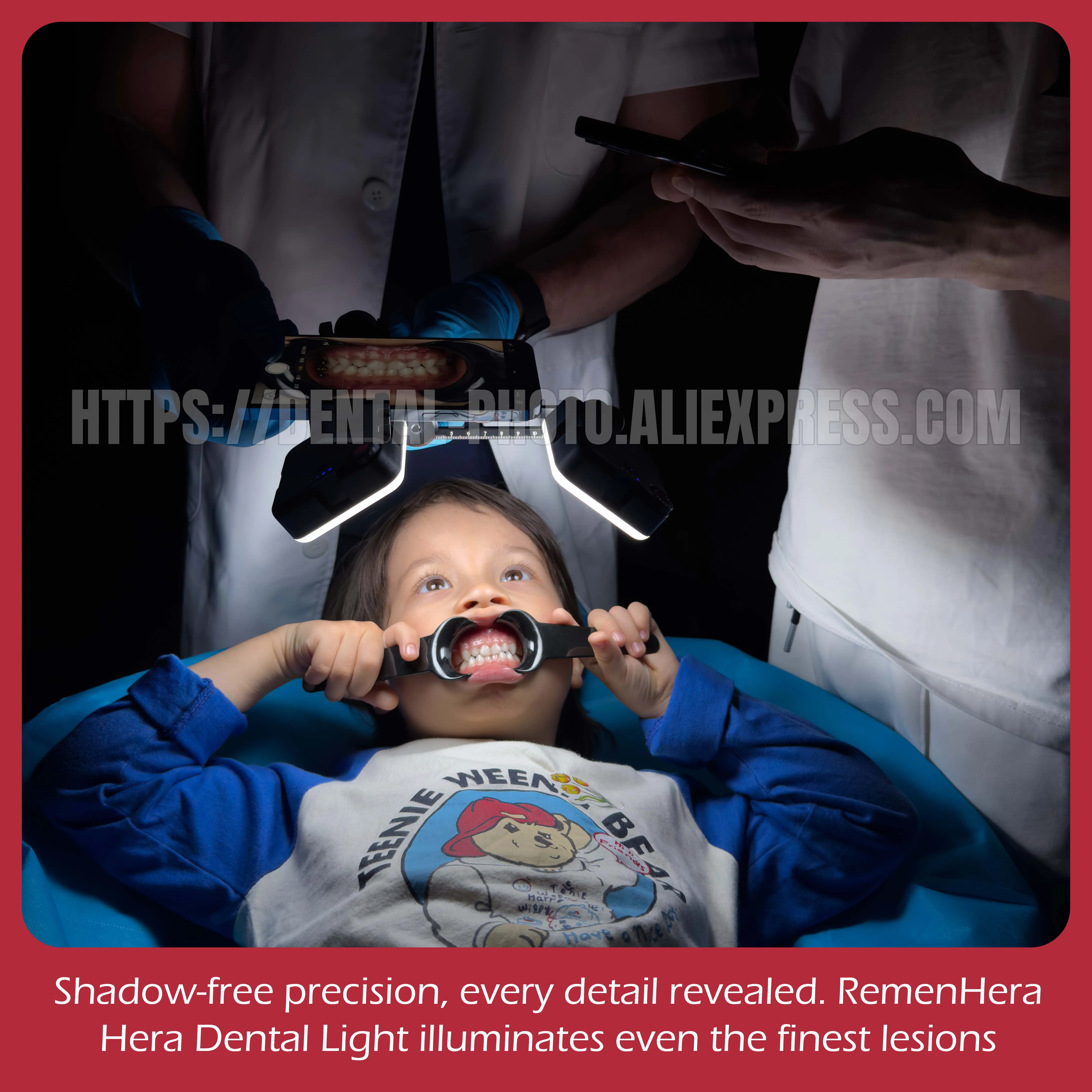 MK17 Mobile Phone LED Fill Light for Macro Photography, Nail Art, Dental Shade Matching, Non-Reflective Intraoral Portable Light