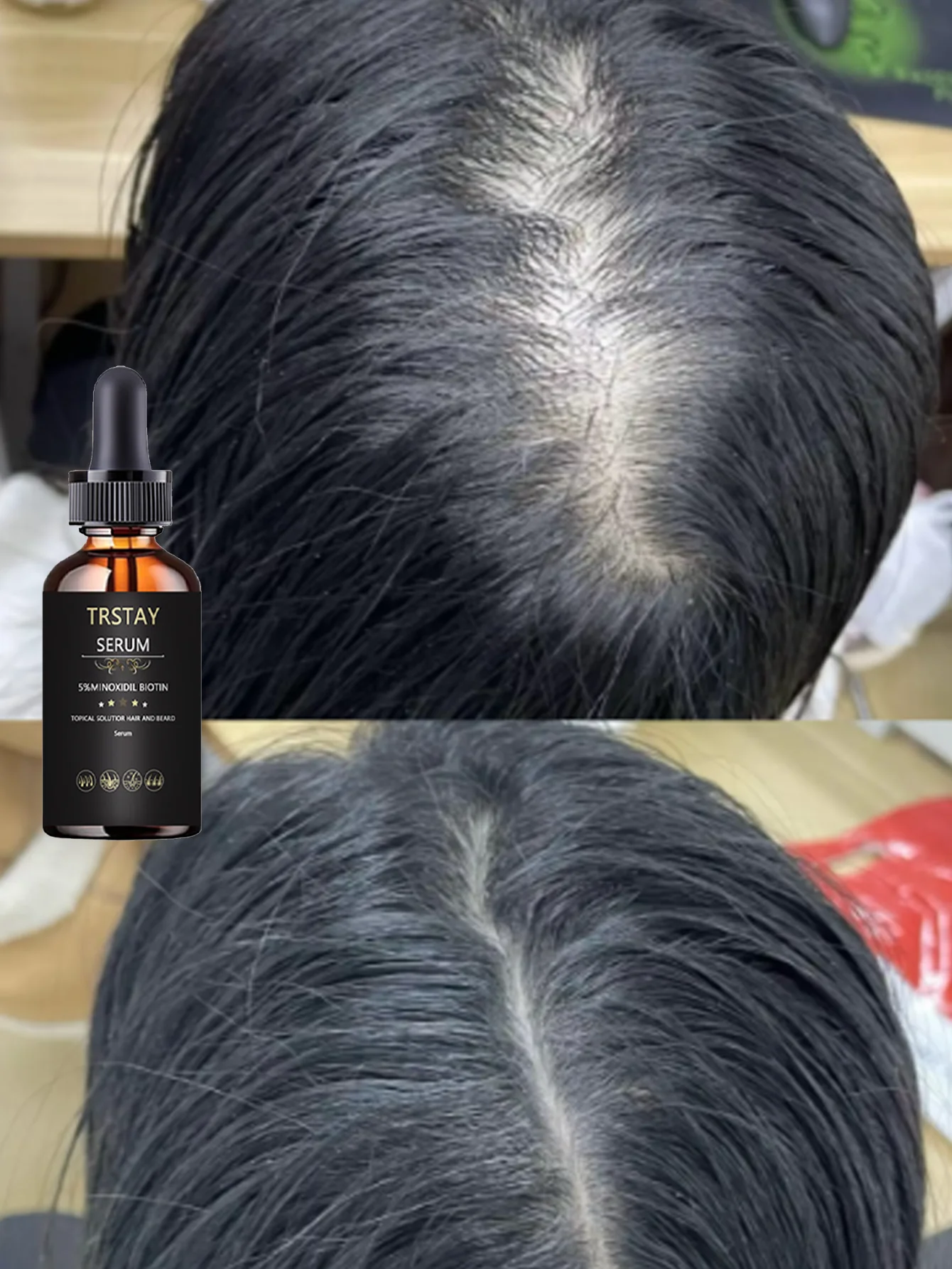 زيت عطري مرطب يعزز الشعر ويحسن مرونة الشعر وترطيب الشعر الناعم ويبدو أكثر سمكًا، محلول العناية بالشعر الطبيعي