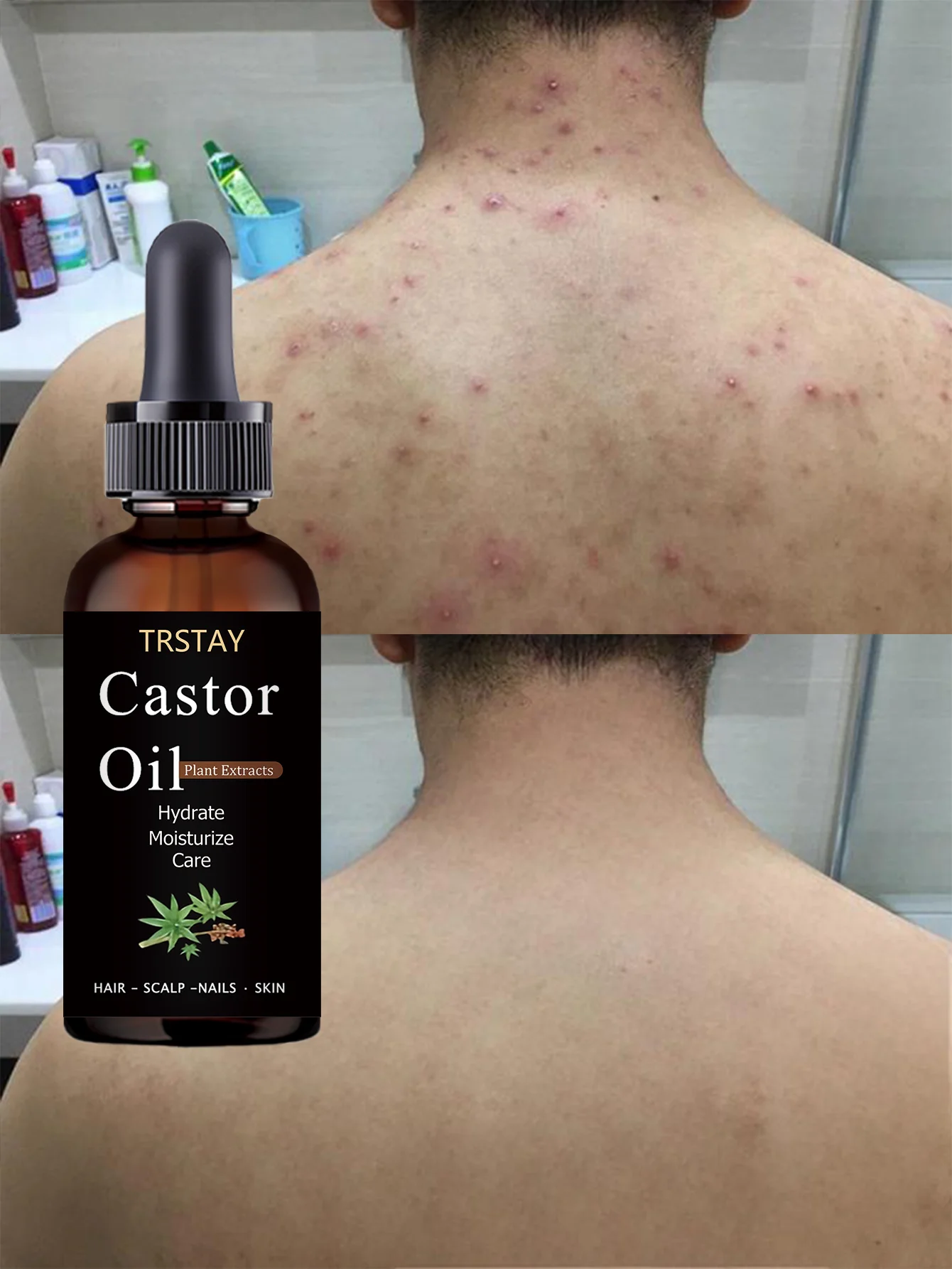 Unscented Lightweight Body Oil with Vitamin E Brightens Skin Deeply Moisturizes Non Greasy Fast Absorbing for All Skin Types