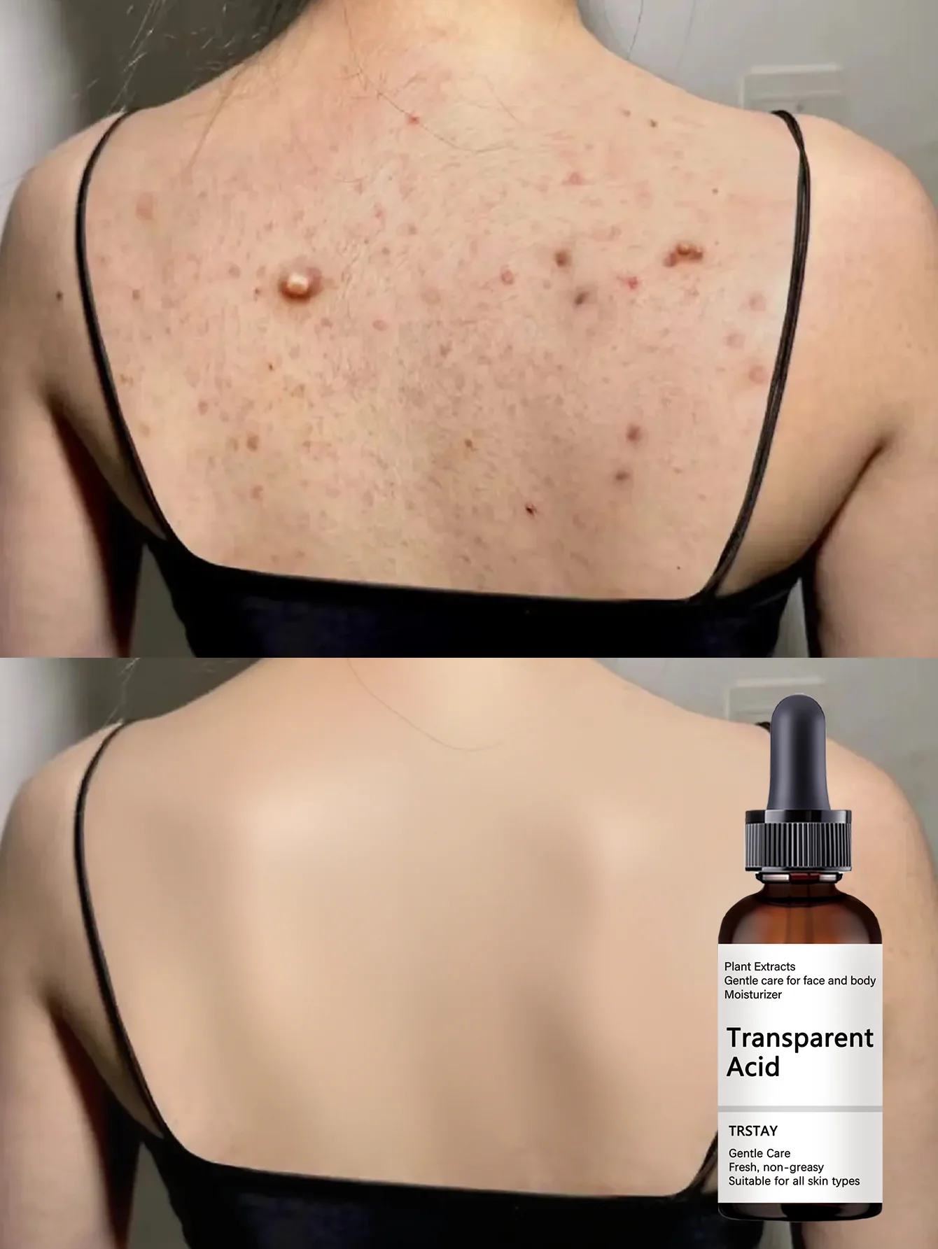 Moisturizing Essential Oil for Lifting and Repairing Delicate Skin with Firming Smoothing Effect to Radiate Youthful Radiance an - Image 4