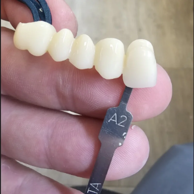 Gudecera Dental Material Zirkonoxid-Mehrschichtblock 98 mm Offenes System 3D PRO Mehrschichtige Zirkonoxidscheibe 20 mm Cad Cam Dentallabore