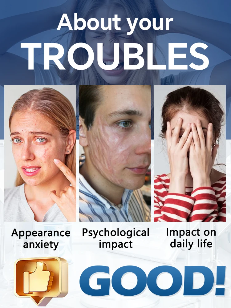 Reparación de cicatrices mejorada de tercera generación, erradia cicatrices en 7 días, diga adiós a las preocupaciones.