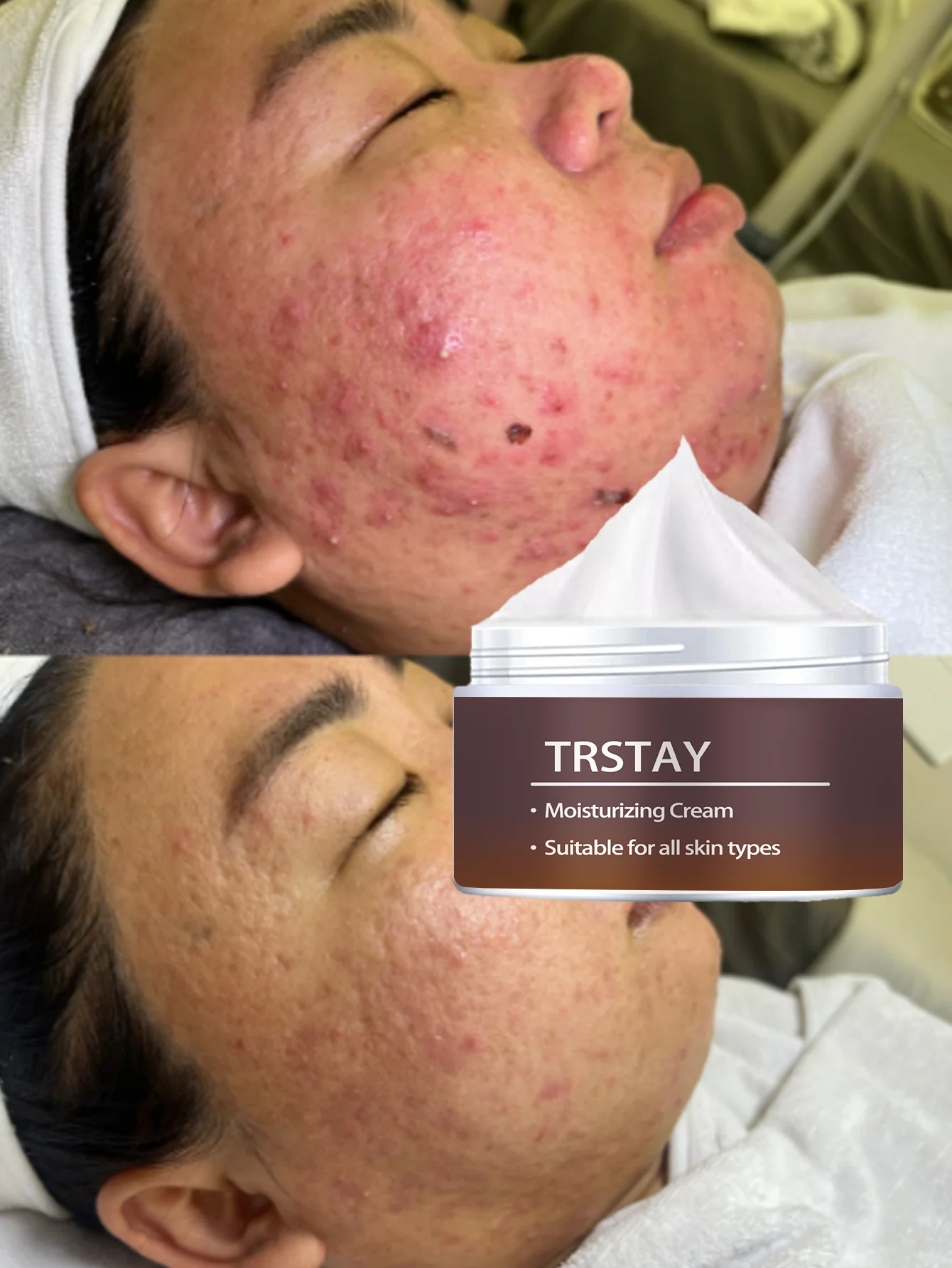 Aceite facial suave hidratante para bebé, suero hidratante nutritivo para todo tipo de piel para pieles sensibles, hidratación profunda, antiedad