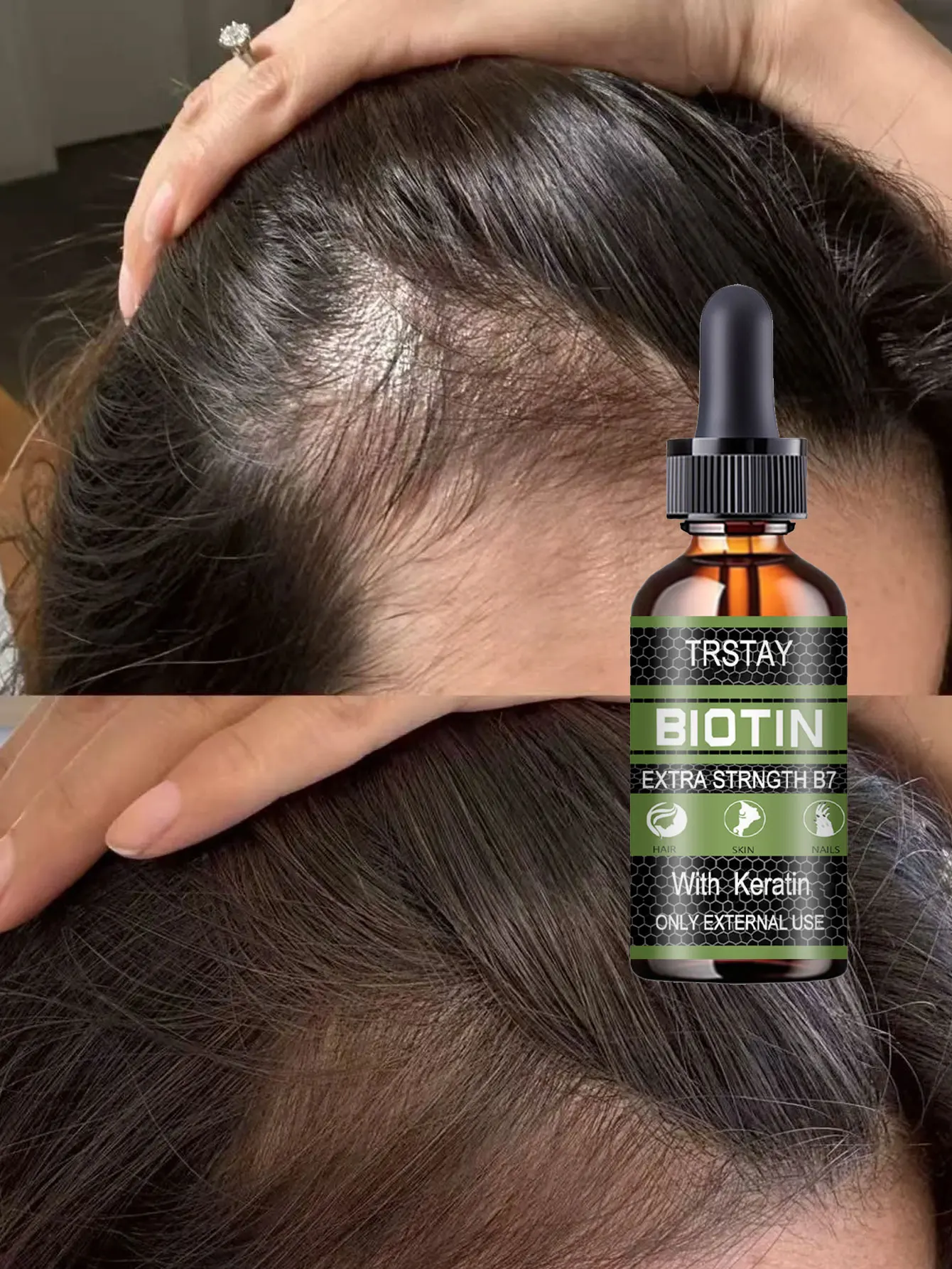 Moisturizing Hair Treatment Oil for Nourishing and Growing Your Hair Reduce Split Ends and Frizz for Thicker Fuller Healthier Lo