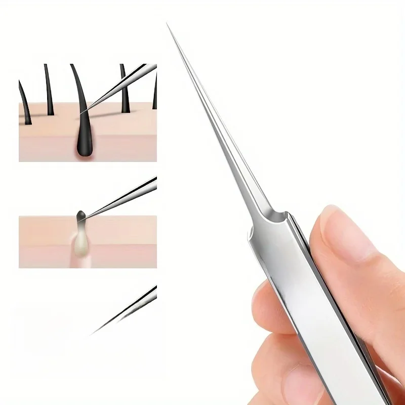 Ensemble d'extracteurs d'acné en acier inoxydable, facile à utiliser, pinces de beauté hypoallergéniques pour peau claire, parfaites pour les débutants