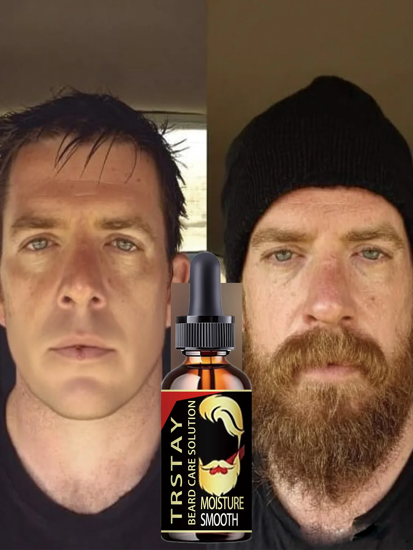 Premium Beard Oil For Men Moisturizes Prevents Dryness Cracking Promotes Thicker Fuller Beard Growth With Essential Nutrients St - Image 5