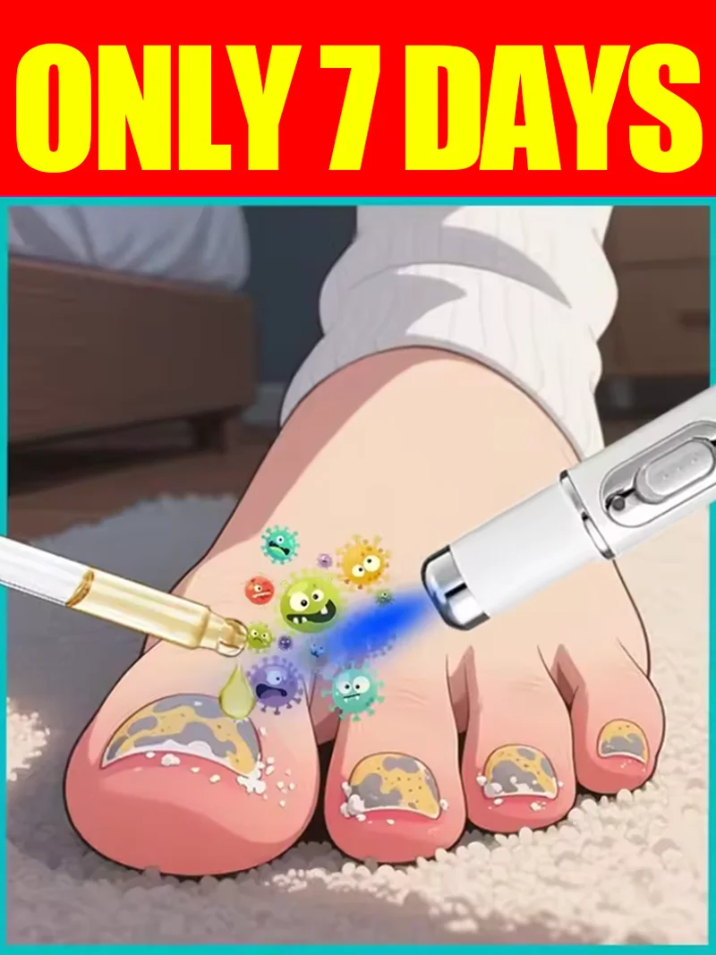 

Generation-2 Laser Says Goodbye To Bad Manicure In 7 Days