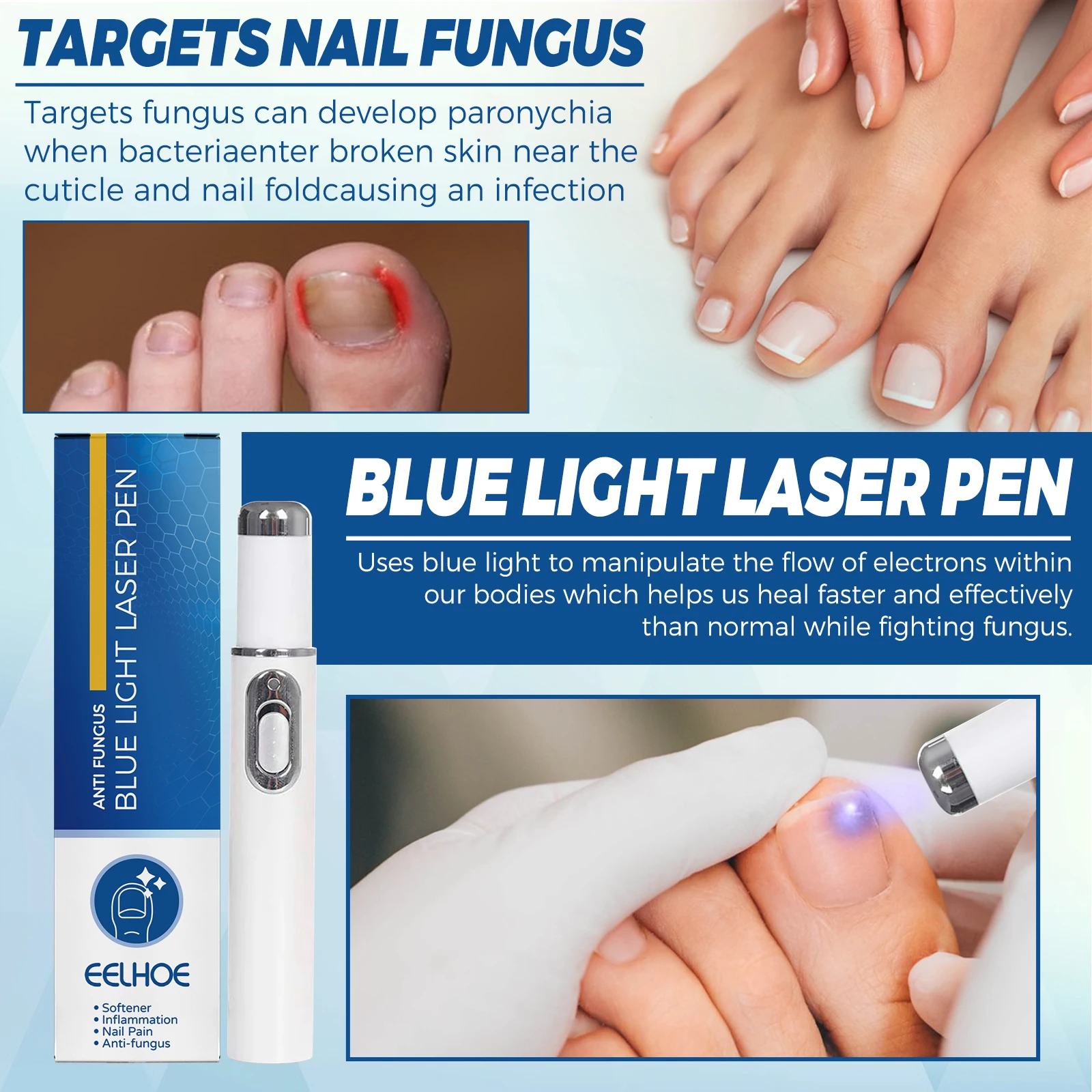 Nail Fungus Laser Treatment Device Fungal Treatment Feet Care Essence Anti Infection Paronychia Onychomycosis Ingrown Toenail