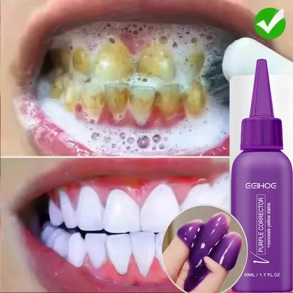 محلول تبييض الأسنان الأرجواني القوي، عامل تبييض تنظيف الأسنان الطبيعي يزيل الأسنان الصفراء وينعش التنفس #3