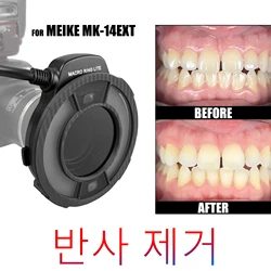 Dental Photo. CPL Polarizing Filter For MEIKE MK-14EXT Flash Ring. Remove Reflections And Glare In Dental Photography
